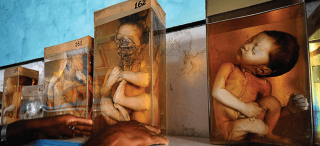 Bhopal gas tragedy case study wiki